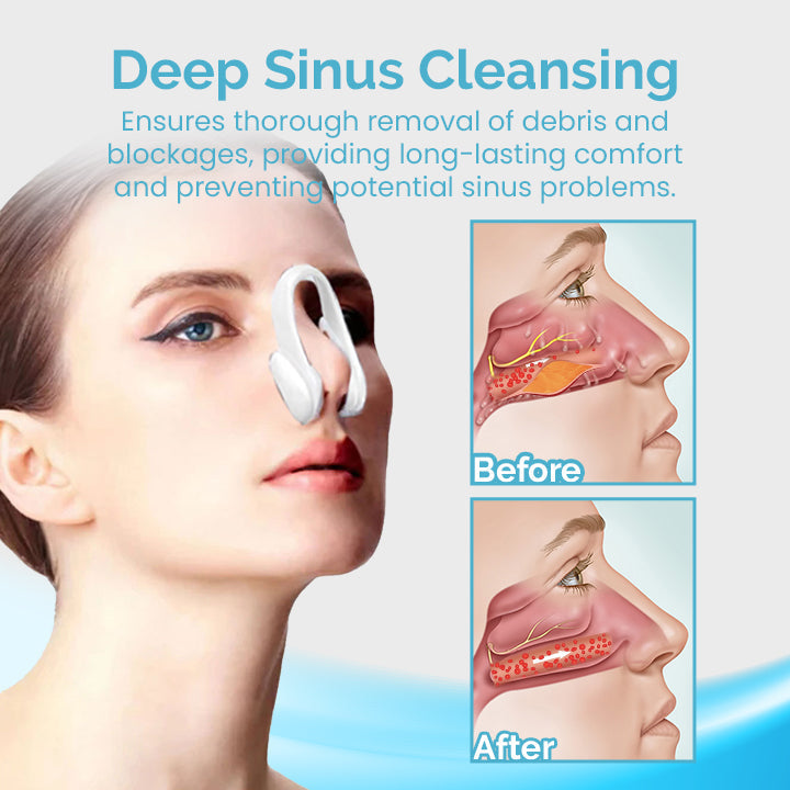 Ceoerty MucusRelief Nasal Cleansing Device