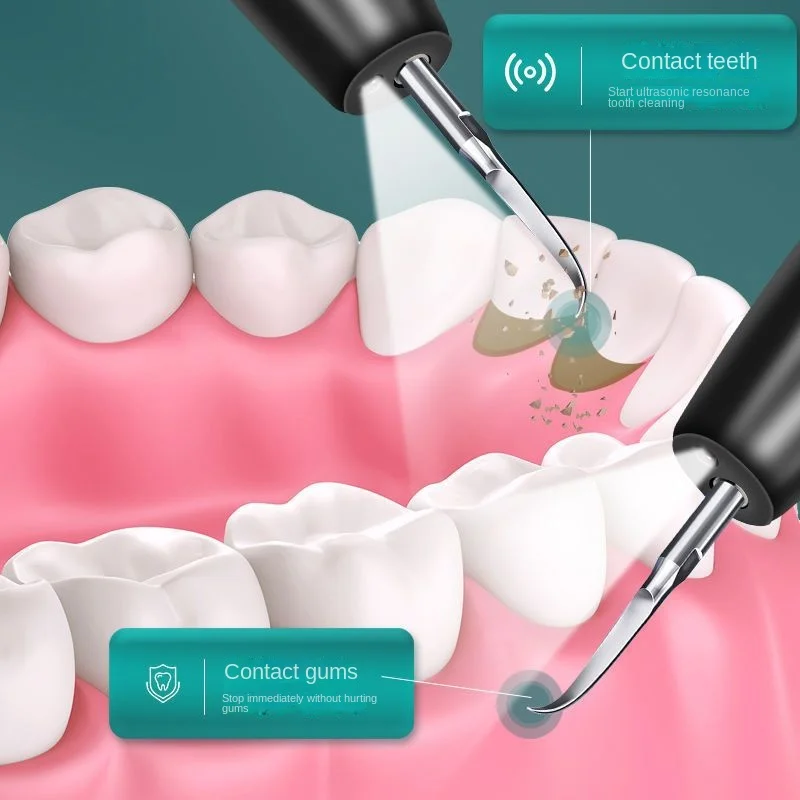 DappSile - Ultrasonic Teeth Cleaner