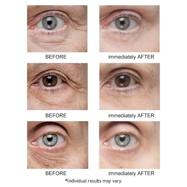 Last Day 49% OFF - Instant Eye Temporary Eye Tightener