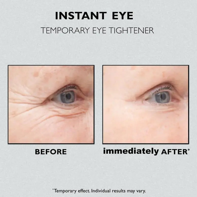 Last Day 49% OFF - Instant Eye Temporary Eye Tightener