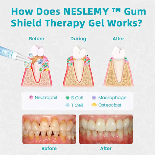 Limit Time 70%Off - NESLEMY Gum Shield Therapy Gel