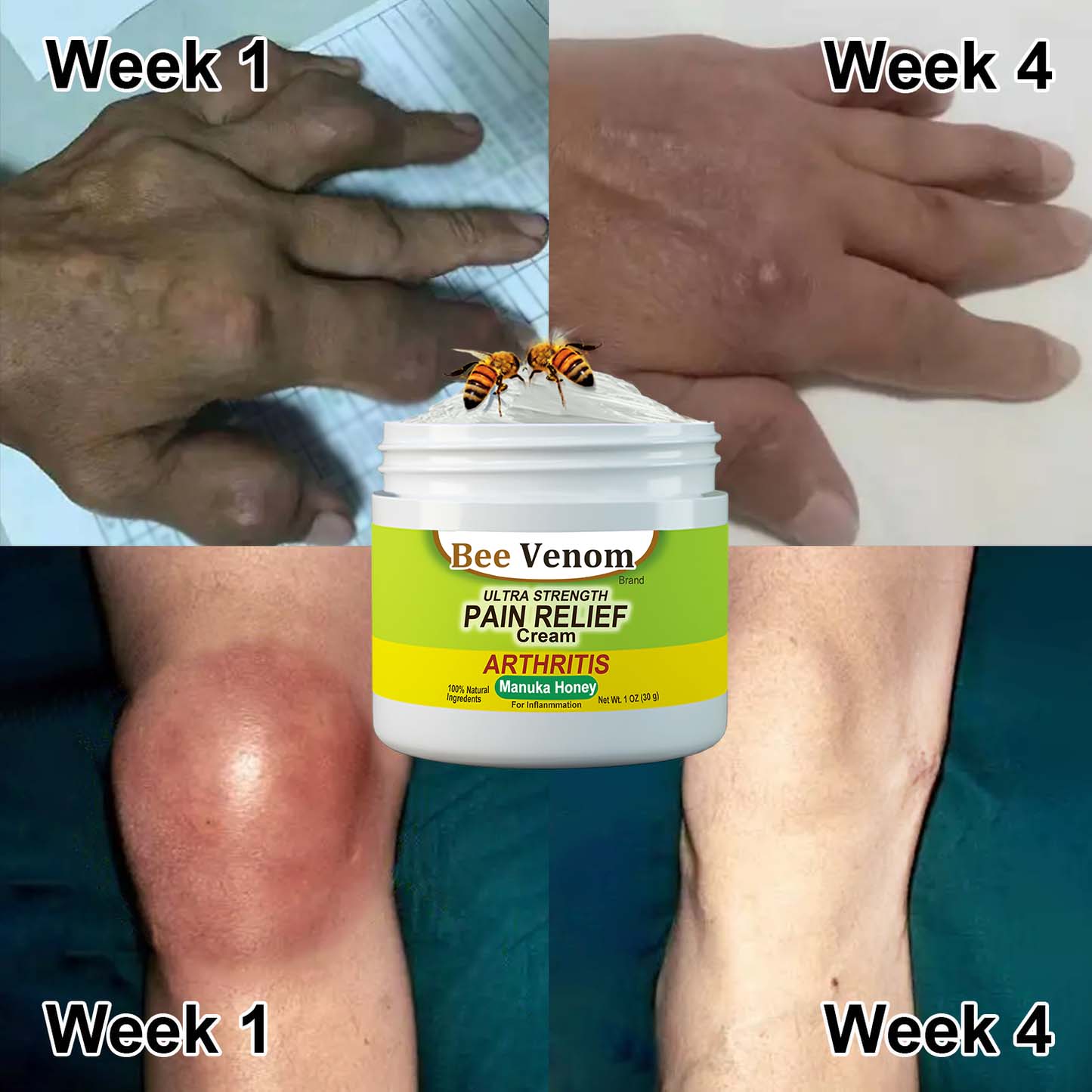 New Zealand Bee Venom Joint and Bone Therapy Advanced Cream