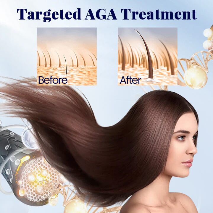 ProtentGro Dense Hair Origin Roller