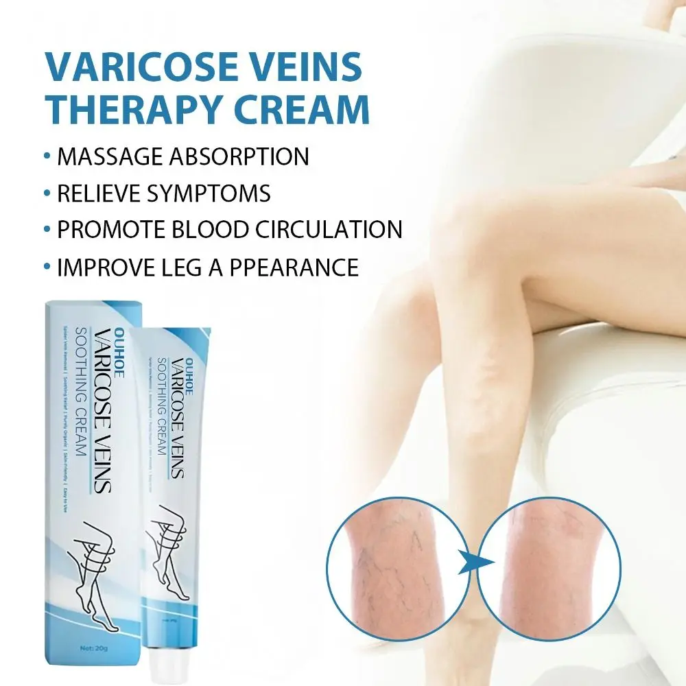 Raura Varicose Veins Treatment Cream