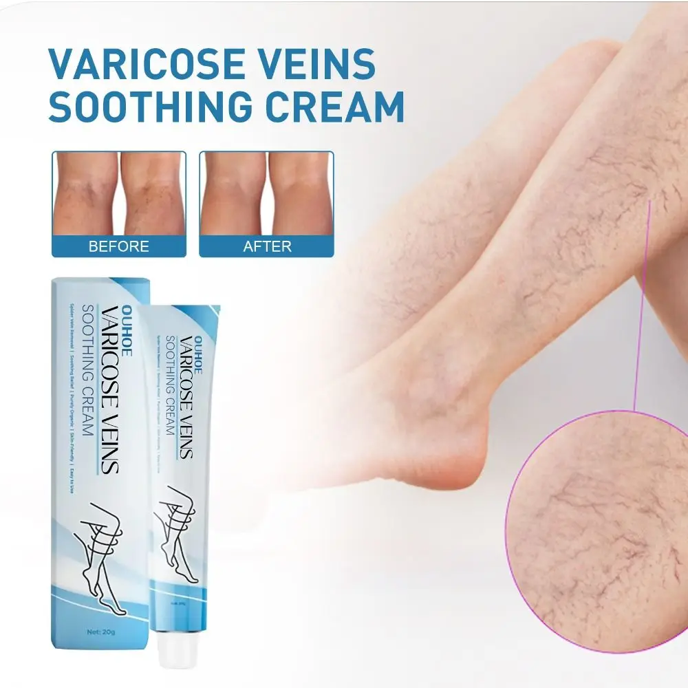 Raura Varicose Veins Treatment Cream