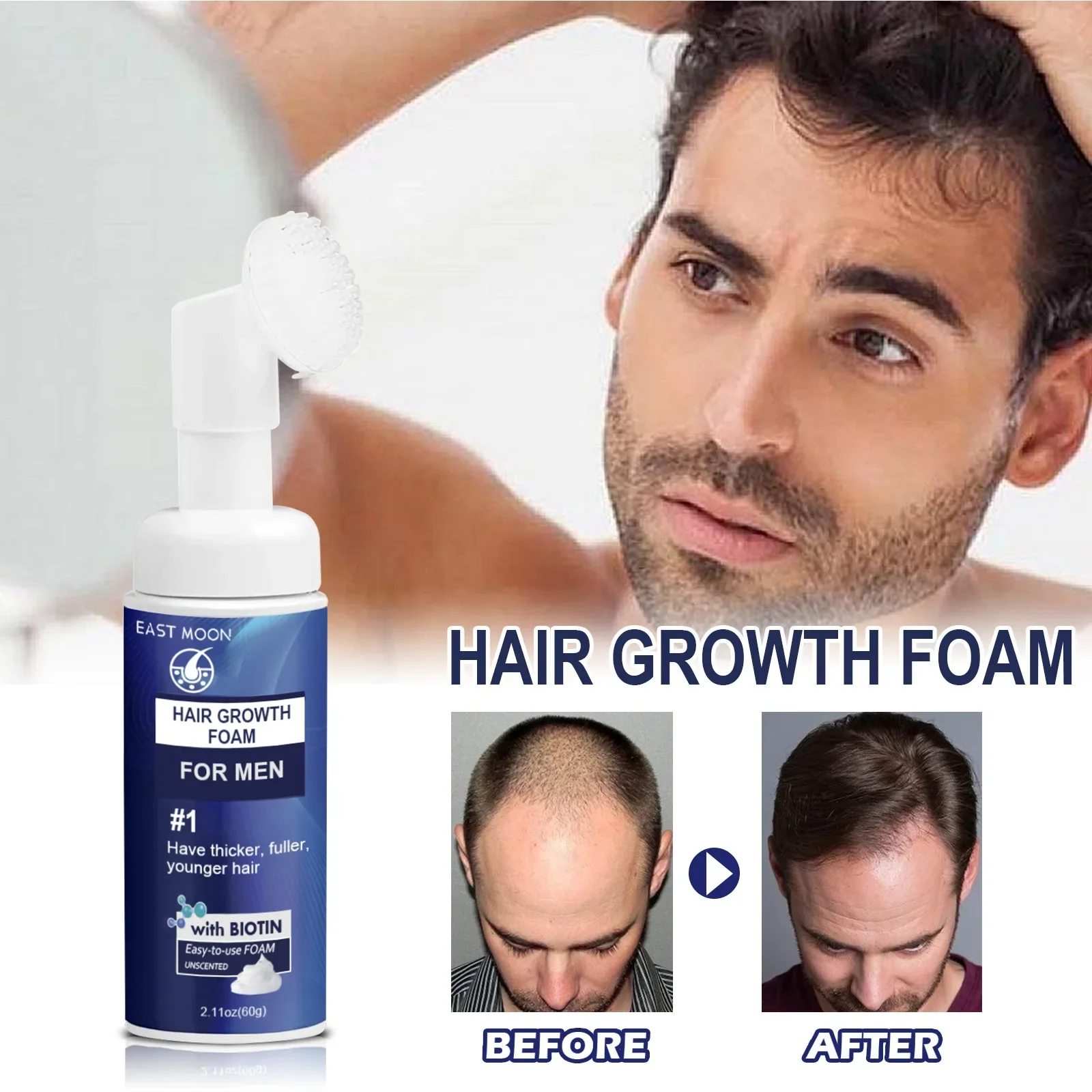 Renewhairx - Hair Growth Foam