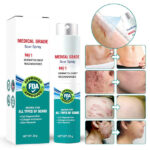 Advanced Scar Spray For All Types of Scars - For example Acne Scars, Surgical Scars and Stretch Marks