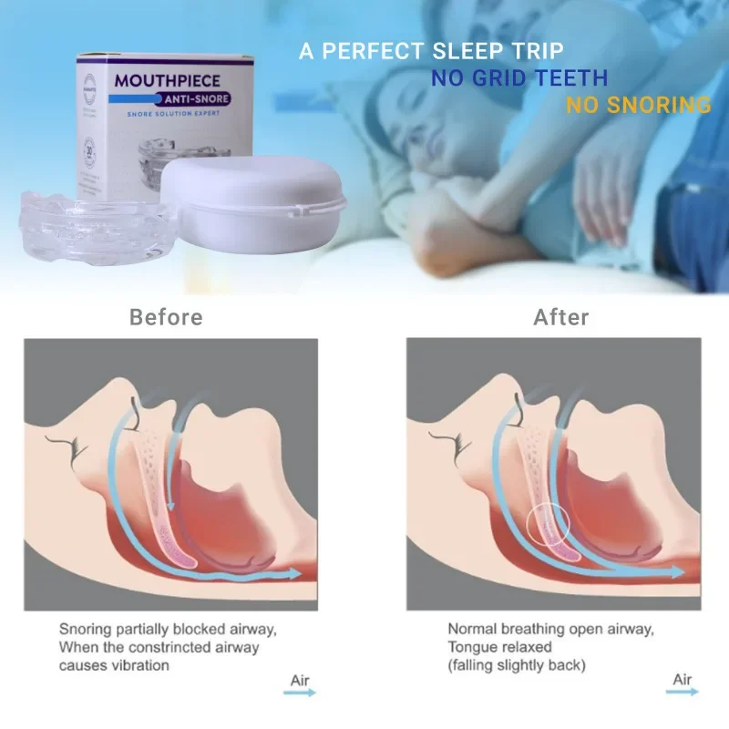 Anti-Snoring Comfort Mouthpiece