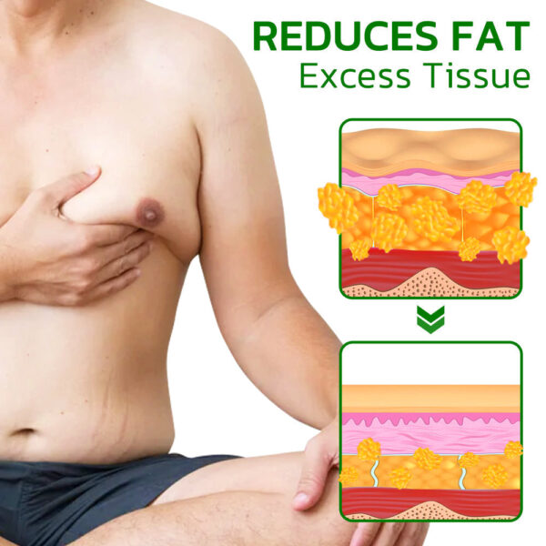 Dobshow TurmericMax Gynecomastia Compress Patch