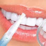 Indulgence Corner - Teeth Whitening Essence