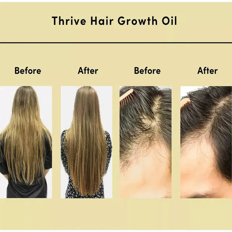 Kinoil - Veganic Hair Growth Oil