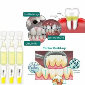 Lenaro Ampoule Toothpaste, Removal of tartar and plaque bacteria and Teeth Whitening Essence Toothpaste.