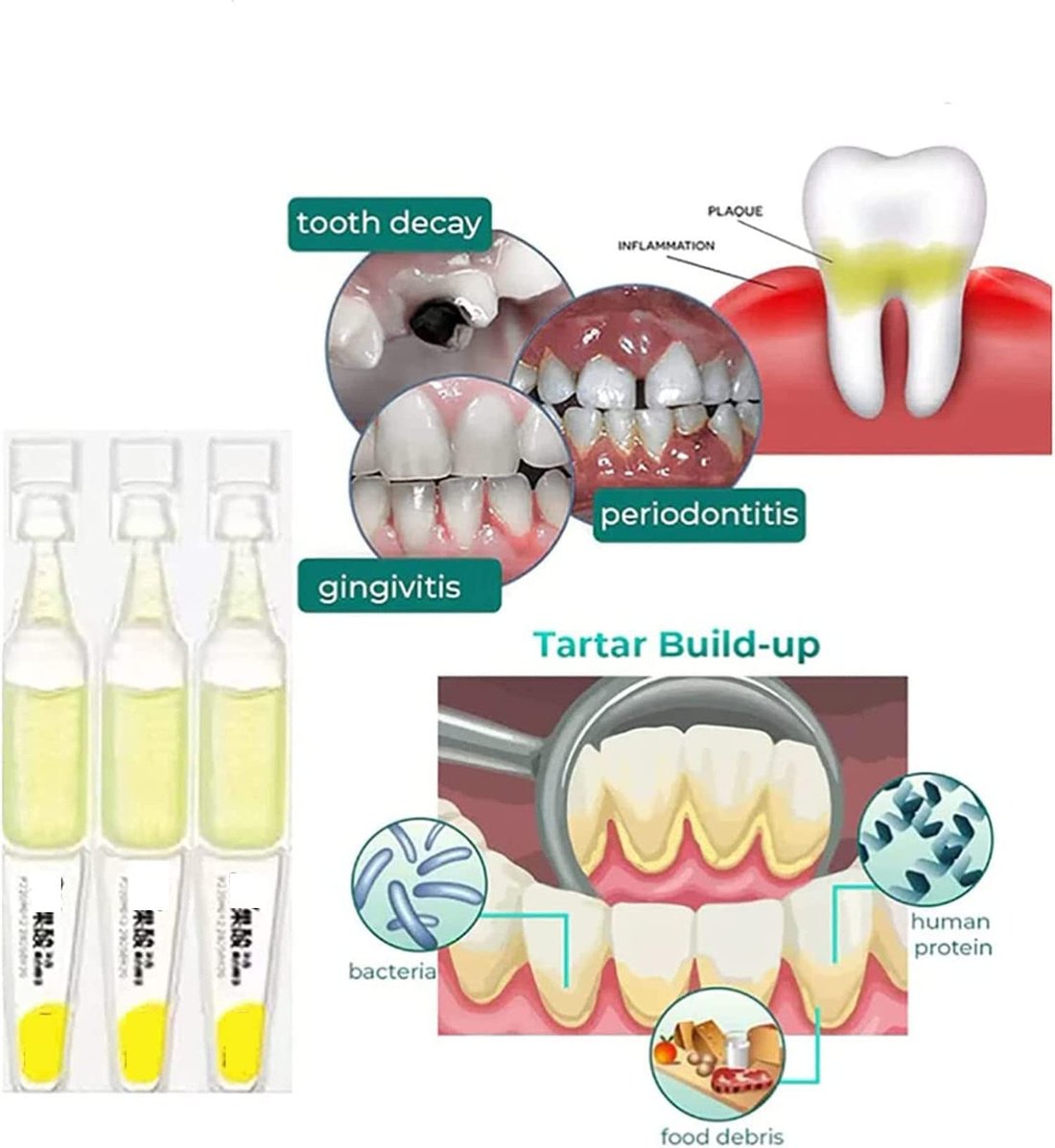 Ampoule Toothpaste, Removal of tartar and plaque bacteria and Teeth Whitening Essence Toothpaste.