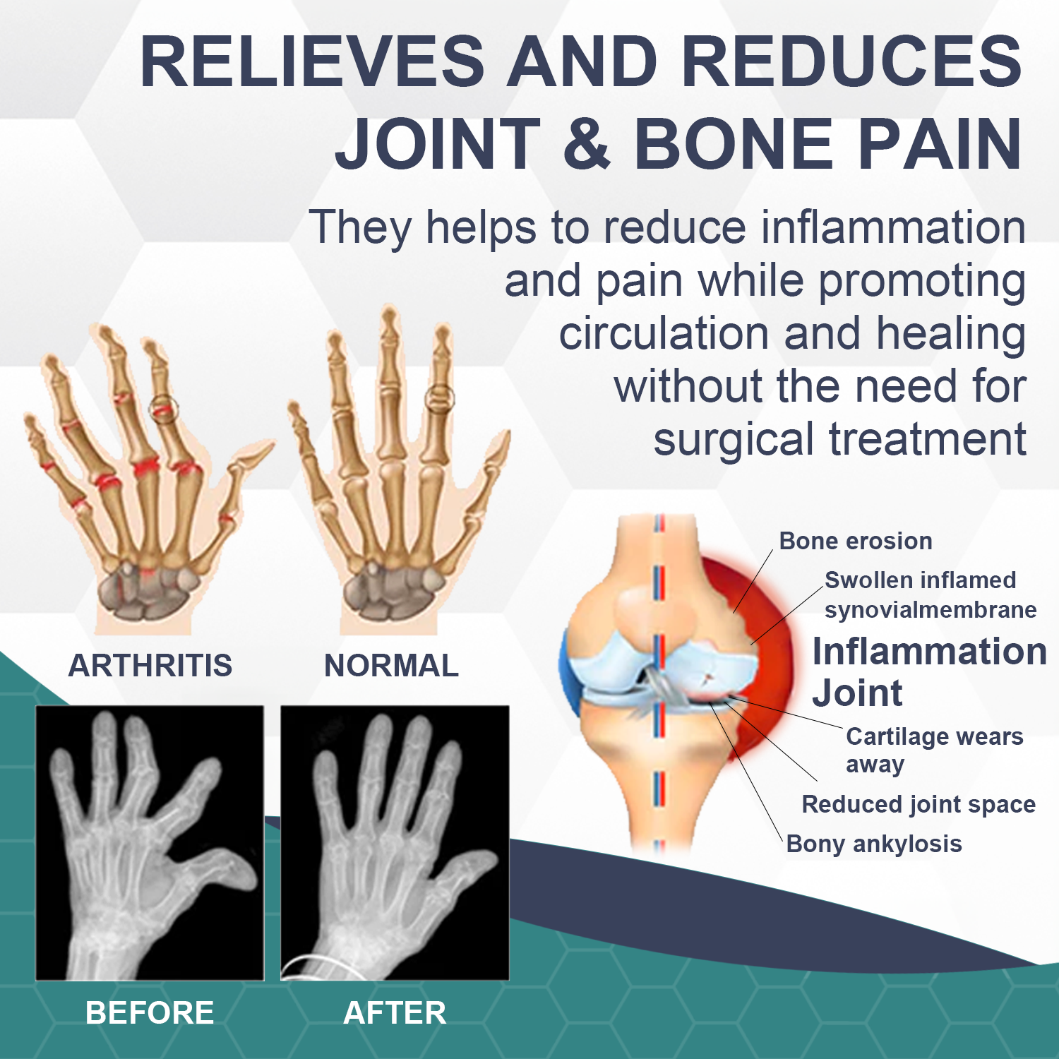 New Zealand Bee Venom Joint Bee Venom Pain and Bone Healing Cream (New Zealand Bee Extract – Specializes in Orthopedic Diseases and Arthritis Pain)