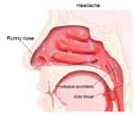 Nurbini RespiRelief red light nasal therapy device