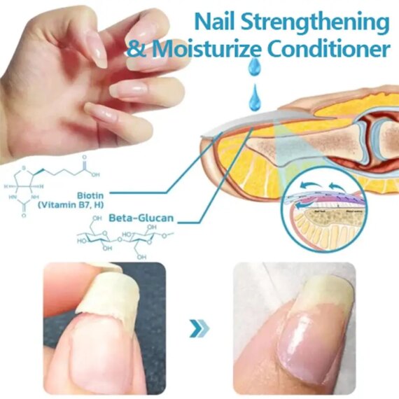 OnyxoGuard Nail Growth and Repair Serum