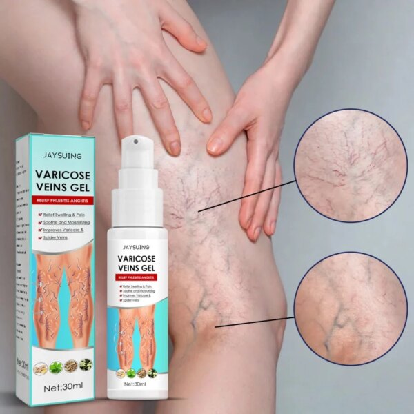 Seurico - Varicose Veins Gel