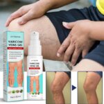 Seurico - Varicose Veins Gel