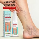 Seurico - Varicose Veins Gel