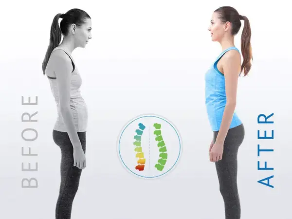 Backletics - Posture Corrector