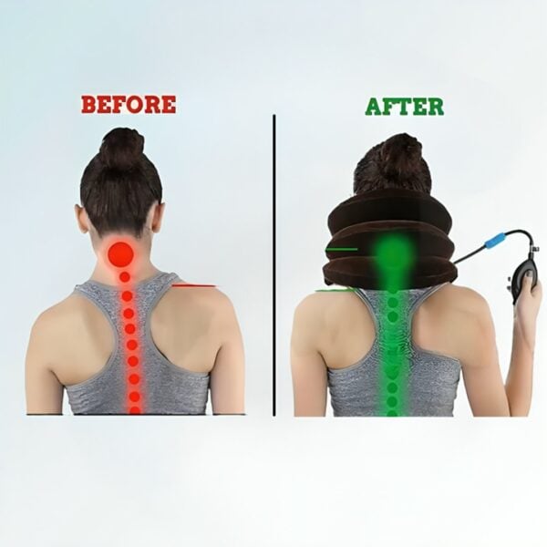 CerviCare - Inflatable Neck Traction