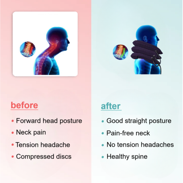 CerviCare - Inflatable Neck Traction