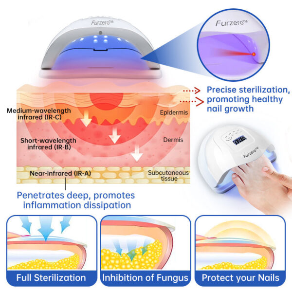 Furzero PureNail Fungus Laser Therapy Device