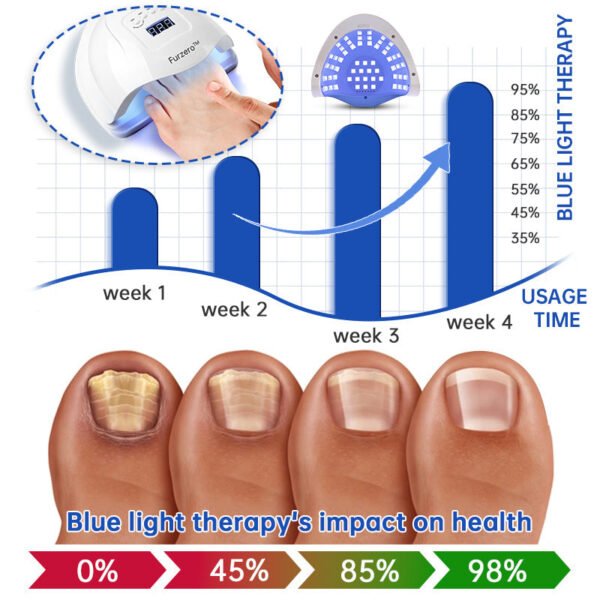 Furzero PureNail Fungus Laser Therapy Device