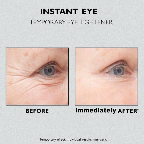 Last Day 49% OFF - Lovilds Instant Eye Temporary Eye Tightener