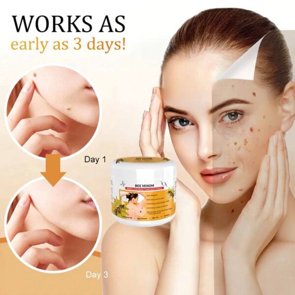 Bee Venom Mole and Wart Treatment Cream