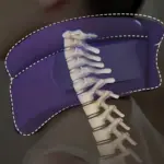 Neck Brace