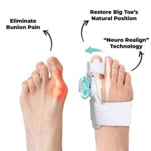 Neuro Bunion Fix with Adjustable Neuro Realign Technology (Eliminate Bunion Pain)