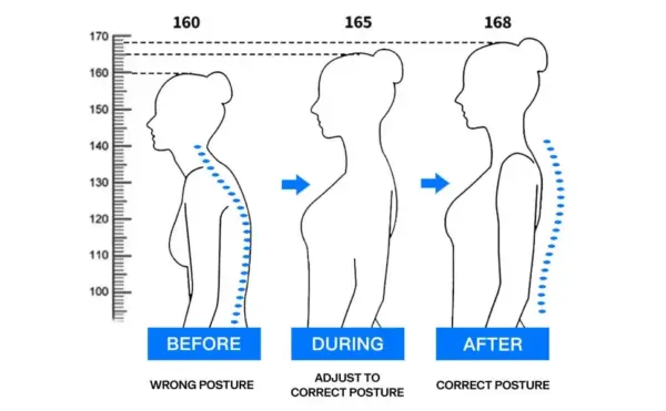 Posture Corrector