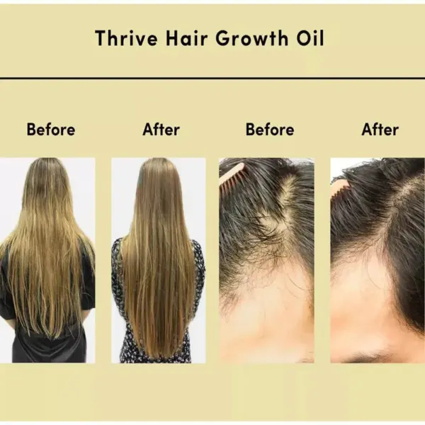 Thrive Hair Growth Essential Oil Hair Daily Care Repair Damage Baldness Scalp Treatment Hair Loss Fast Growing Germinal Serum