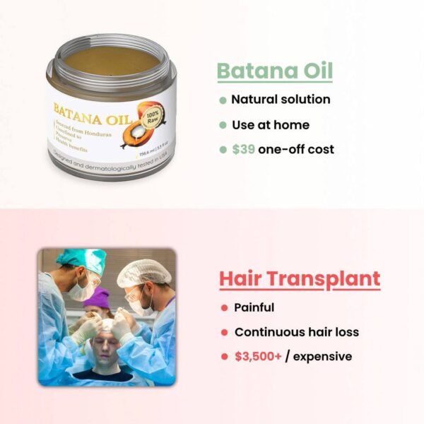 Batana 100% Natural Hair Growth Oil