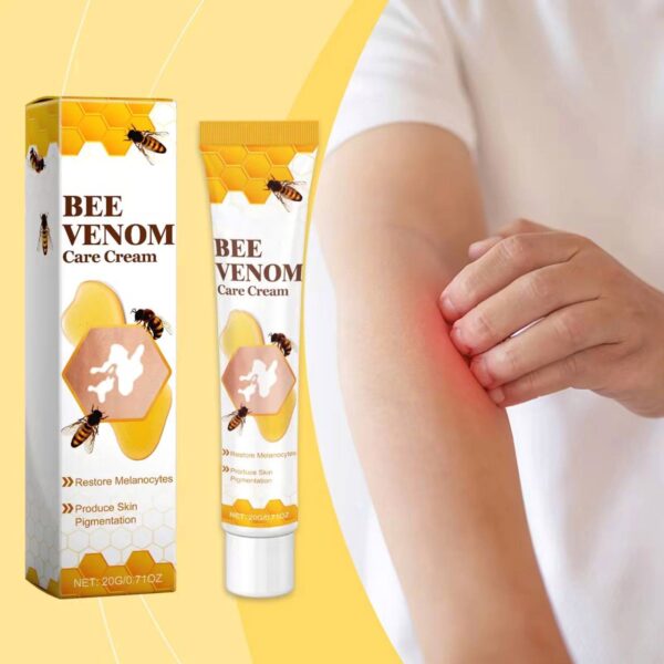 Bee Venom Vitiligo Cream