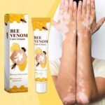 Bee Venom Vitiligo Cream