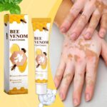 Bee Venom Vitiligo Cream