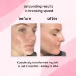 GlowClear Exfoliating Pads