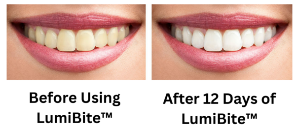 LumiBite