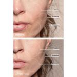 LUMINESCE GLOW 7-in-1 LED Facial Sculptor