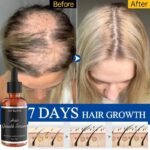 Rennora Hair Growth Serum