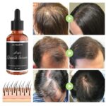 Rennora Hair Growth Serum