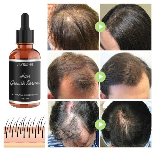 Rennora Hair Growth Serum