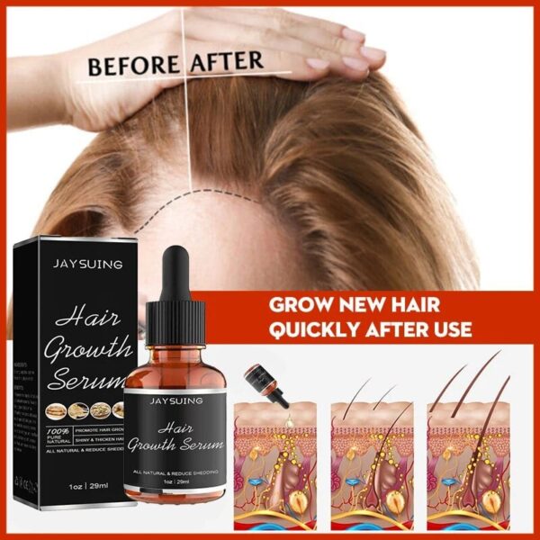 Rennora Hair Growth Serum