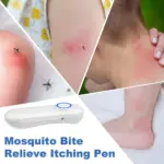 ZapEase: Insect Bite Relief