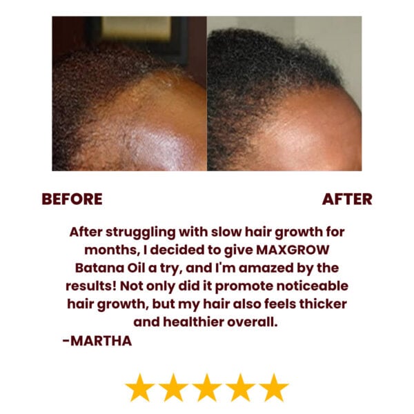 Batana Natural Hair Growth Oil