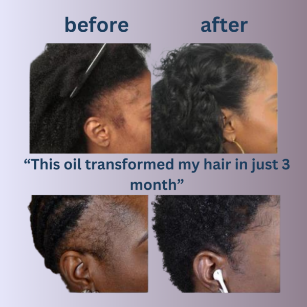 Batana Natural Hair Growth Oil