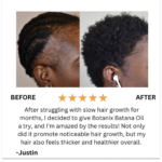 Batana Natural Hair Growth Oil