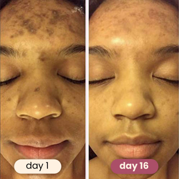 brightening turmeric & kojic acid pads